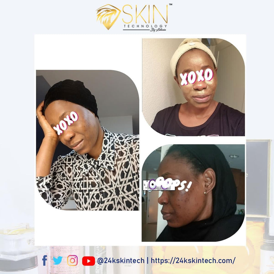 24 Kt. Gold Facial Mask with Hylauronic Acid 4.75 oz – Skin